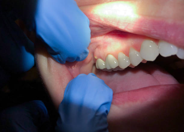 Best Broken or Cracked Tooth Emergency Dentist in Winnsboro Mills, SC